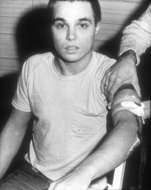 Chris Burden in 1971, being bandaged after his infamous "Shoot" piece. 