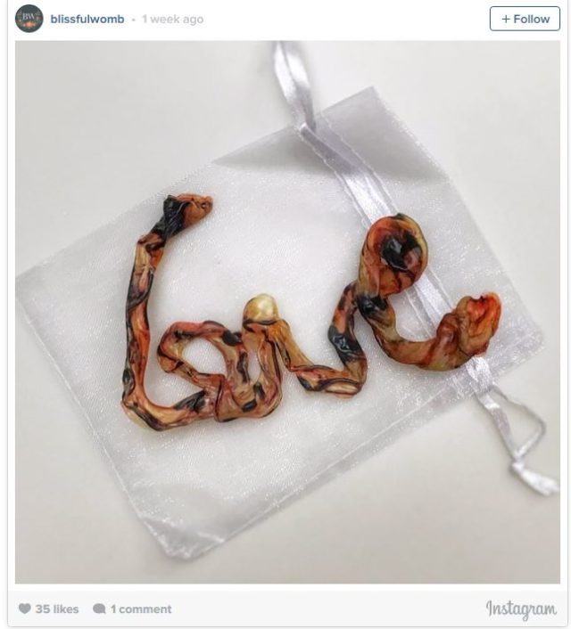 "Umbilical cord art" is now a trend, according to Buzzfeed. 